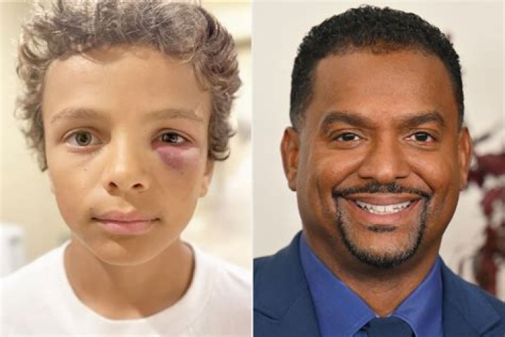 Black Kudos &bull; Alfonso Ribeiro Alfonso Lincoln Ribeiro (born...