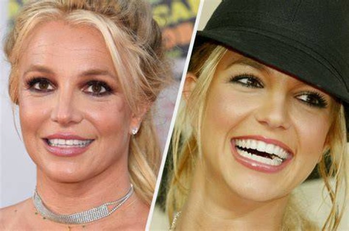 britney spears teeth p&egrave;re de britney spears Genertore2