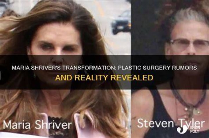 Did Maria Shriver Have Plastic Surgery? Rumors of Facelift, Fillers