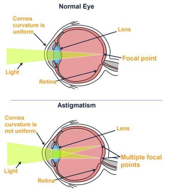 How Astigmatism Affects Vision Davis Vision Center