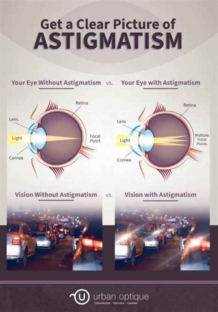 How Do People With Astigmatism See? Astigmatism Vision Comparison