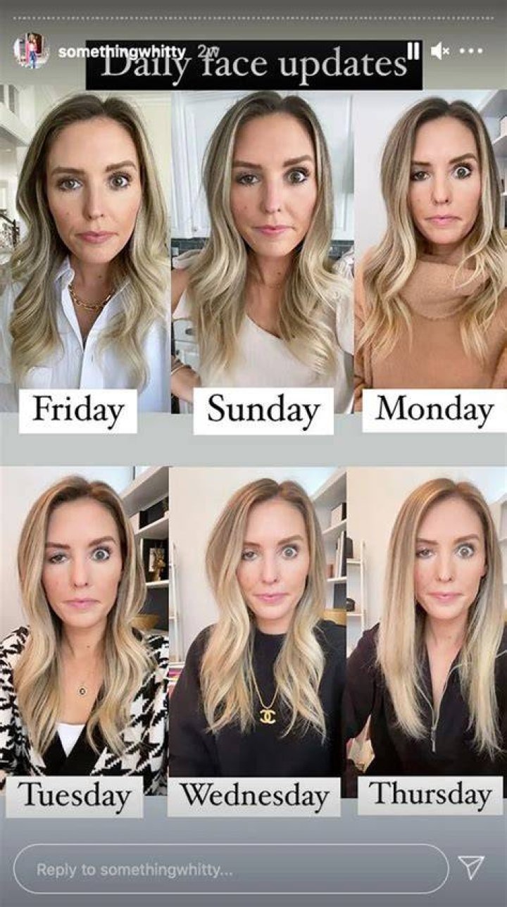 Influencer Whitney Buha Candidly Reveals What Happens When Botox Goes