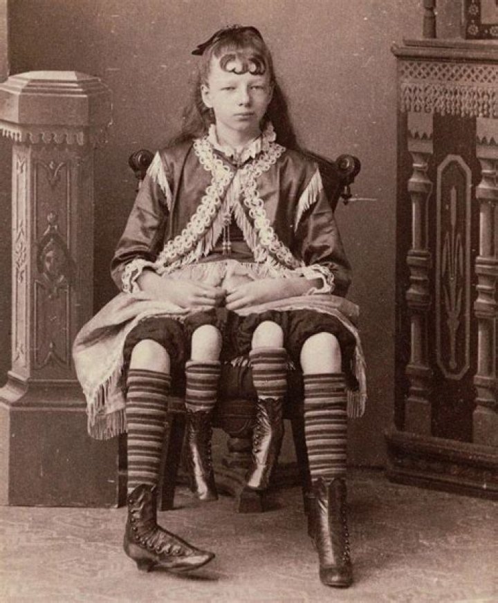 Josephine Myrtle Corbin / Josephene, la mujer de 4 piernas. Esfera