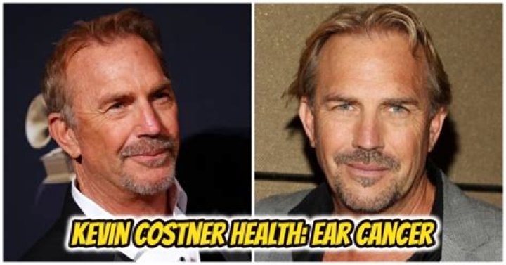 Kevin Costner Ear Cancer Surgery Update What Happened?