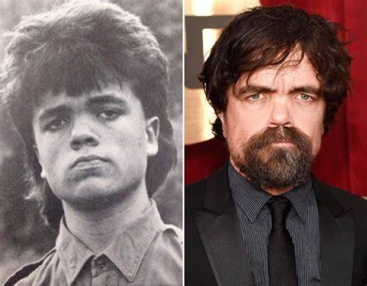 Peter Dinklage Childhood Story Plus Untold Biography Facts